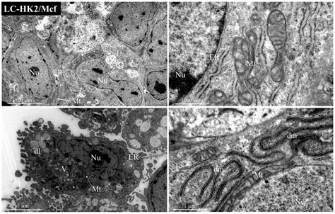 Characterization of 3D NSCLC Cell Cultures with Fibroblasts or ...