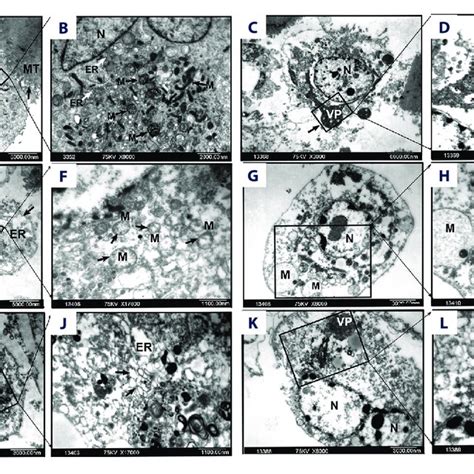 Electron Microscopy Cell 的图像结果