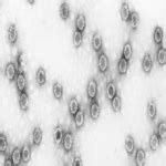 Crop Protection >> Diseases >> Grassy Stunt & Ragged Stunt Virus