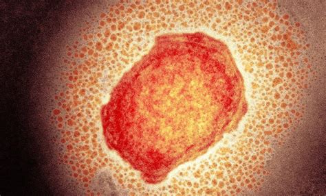 WHN Declares Monkeypox A Pandemic; Urges WHO To Consider Amid Exploding ...