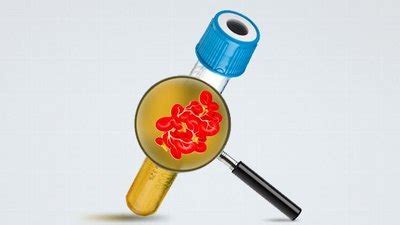 Hemostasis Guide to introduce Hemostasis Principles | HORIBA