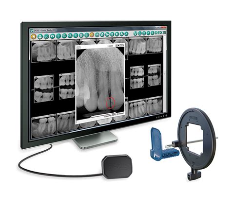 DEXIS Platinum Digital Imaging System | November 2016 | Inside Dentistry