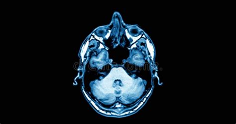 Image result for Body Parts Scan