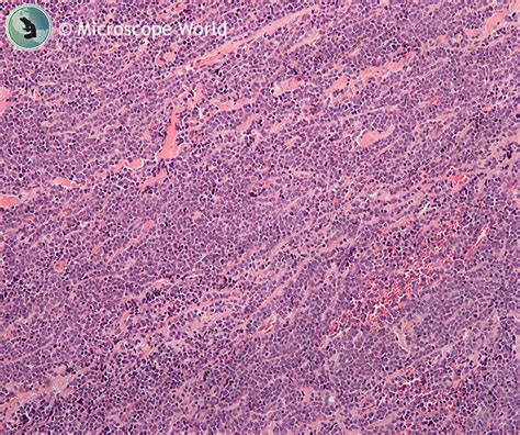 Image result for Tissue Sample Test