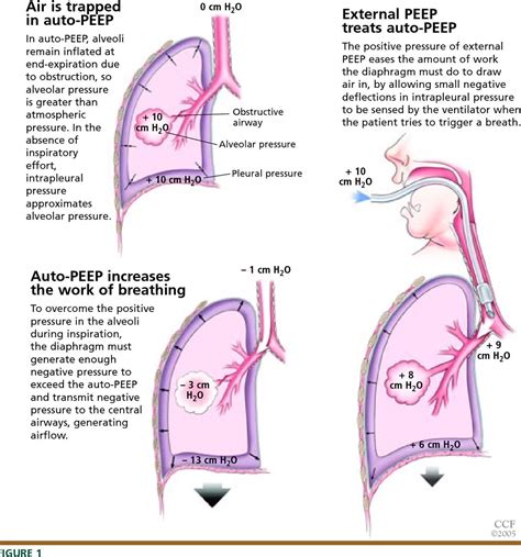 A thread on mechanics, logistics and reasons behind positive end ...