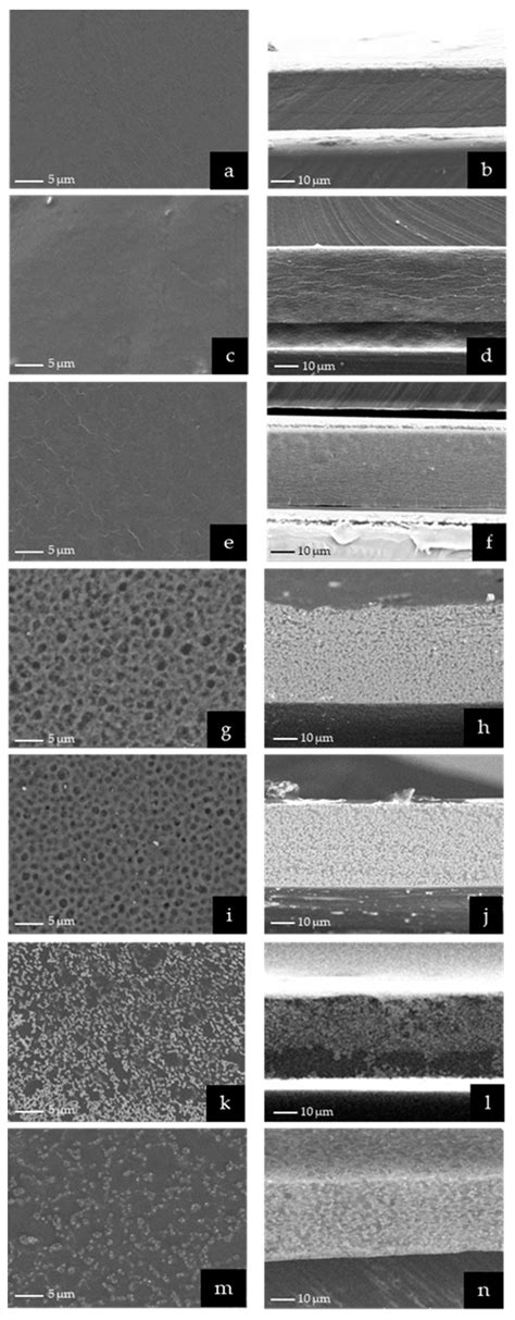 Nanoemulsion-Based Orodispersible Film Formulation of Guava Leaf Oil ...