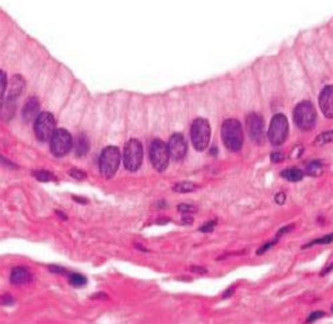 Image result for Ephilehal Tissue Sample