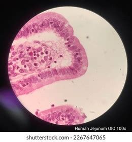 Image result for Jejunum Microscope