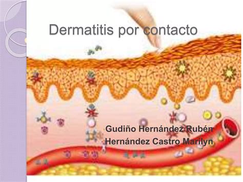 Dermatitis por contacto | PPTX