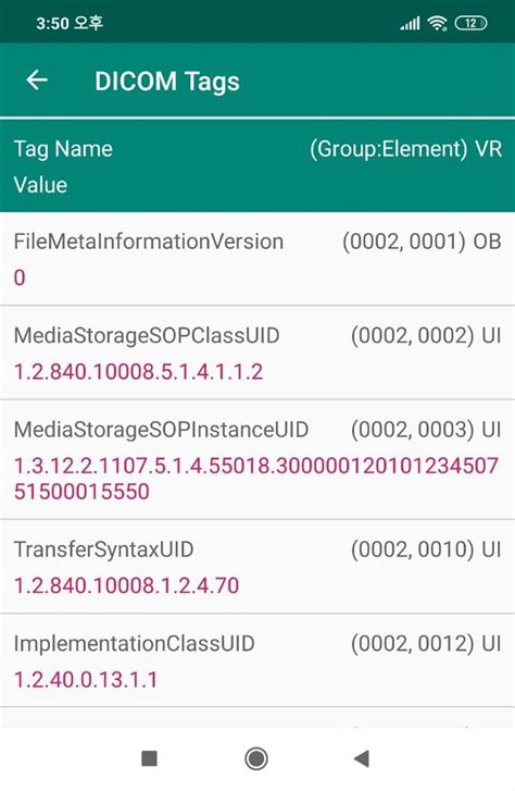 Load File DICOM Viewer 的图像结果