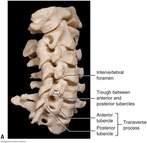 Introduction to (overview of) the cervical spine of the neck
