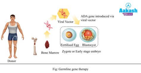 Gene Therapy Types, Genetically Engineered Insulin & Molecular ...