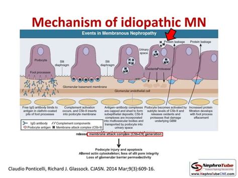 Image result for Nephrohydrosis Algorithm