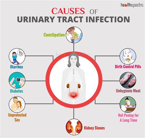 [DIAGRAM] Diagram Of Uti - MYDIAGRAM.ONLINE