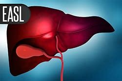 EASL | MedPage Today