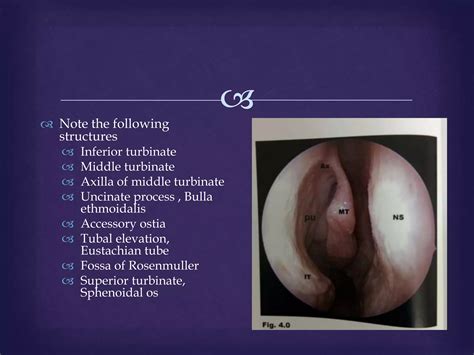 Anatomy of lateral wall of nose with relevance | PPTX