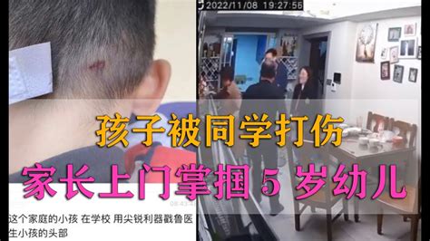 被同学踢伤下体，6岁男童睾丸被切除！_腾讯视频