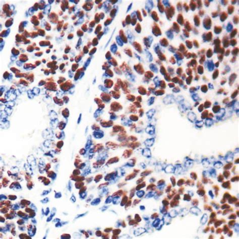p63-4A4 | PathnSitu Biotechnologies