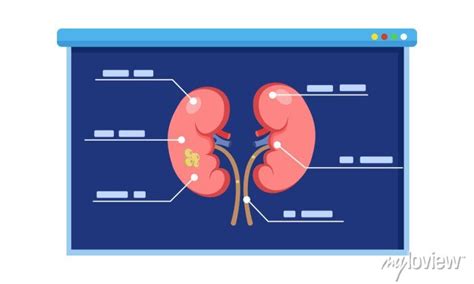 Image result for Kidney Tutorial
