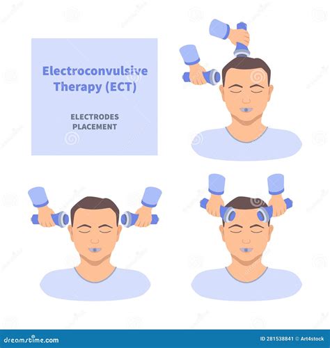 Electroshock Treatment
