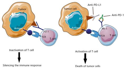 Modern Immunotherapy in the Treatment of Triple-Negative Breast Cancer