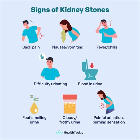 Do Kidney Stones Cause Back Pain? Signs To Tell - HealthToday