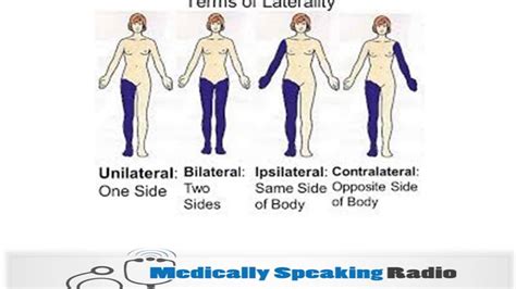 Image result for Contralateral Body Parts Example