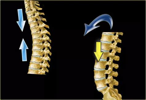 Posterior percutaneous long-segment internal fixation effective for ...