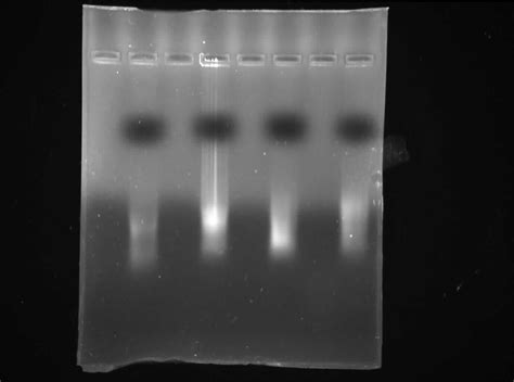 Isolation of RNA From Bacteria 的图像结果