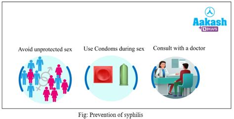 Syphilis: Causative Agent, Symptoms, Diagnosis, Treatment and ...