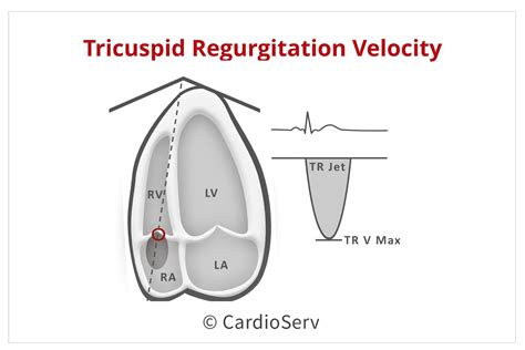 Correct Techniques to Acquire Diastology Measurements - Cardioserv