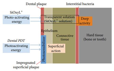 Peri-Implantitis Management: Surgical versus Non-Surgical Approach ...
