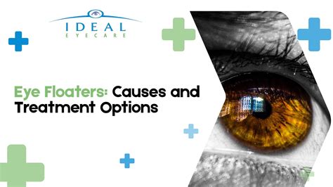 Eye Floaters Explained: Causes, When to Worry, and Treatment Options