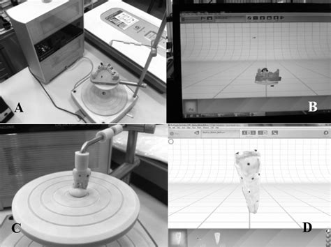 Image result for Scanning Process for Scan Body and Model