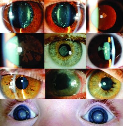 Image result for Iris Recognition Using MATLAB Source Code