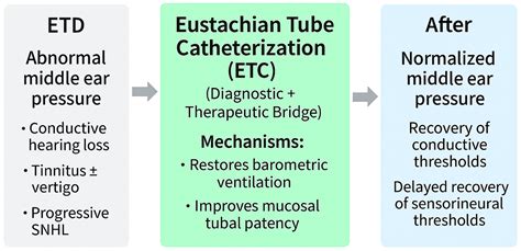 Eustachian Tube Dysfunction in Hearing Loss: Mechanistic Pathways to ...