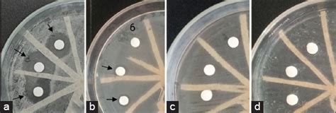 Production of antibacterial substance by immobilized cells of ...