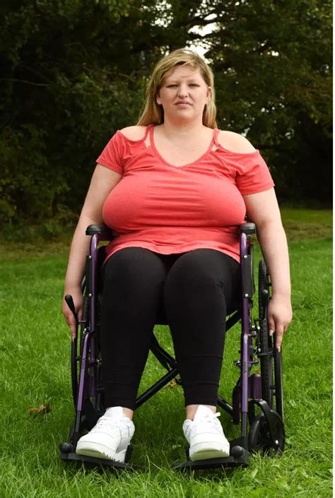 Woman's Breasts caused Spine Collapse