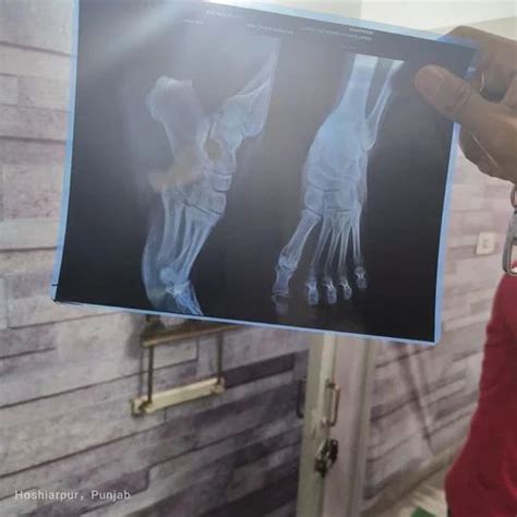 Digital X Ray System - X Ray Dr System Manufacturer from Dera bassi