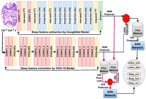 Histopathological Analysis for Detecting Lung and Colon Cancer ...