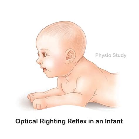 Optical Righting Reflex Infants