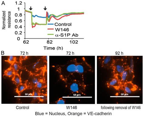 Cells | Special Issue : Sphingolipids: From Pathology to Therapeutic ...