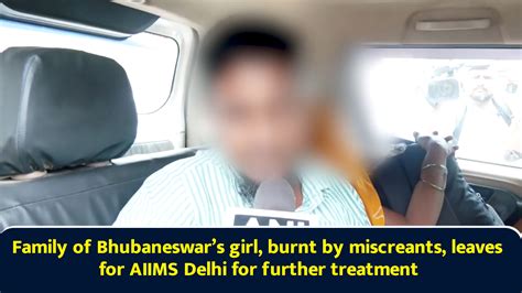 Family of Bhubaneswar’s girl, burnt by miscreants, leaves for AIIMS ...