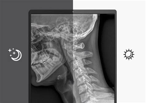 Buy LG 21.3 (54.102cm) 3MP IPS Diagnostic Monitor in India | LG India ...