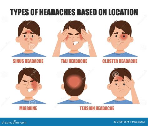 Types Of Headaches By Location