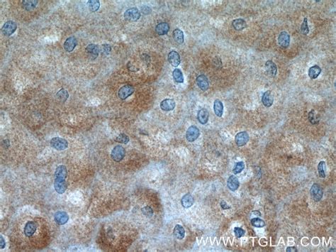 SPRR2D antibody (23046-1-AP) | Proteintech