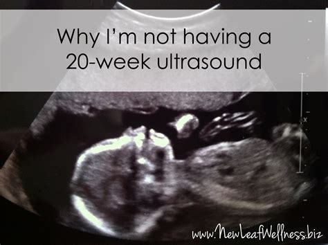 Fetal Anatomy Ultrasound At 20 Weeks 20 Week Screening Scan GOV.UK