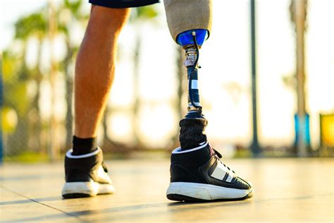 Prosthesis: An Overview of Types, Benefits, and Challenges - Prosthetic ...