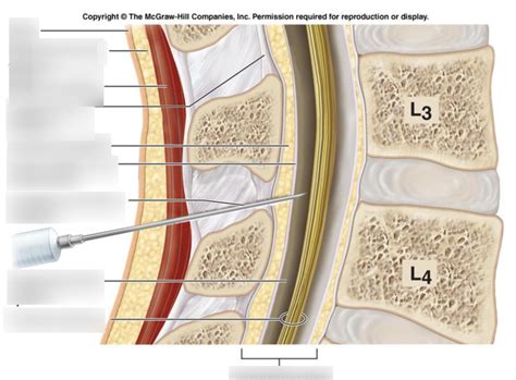 Image result for Spinal Tap Stumpy
