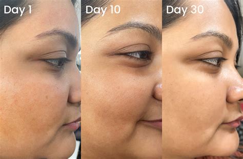 Buy Hydrating Serum With Hyaluronic Acid for Face | Foxtale